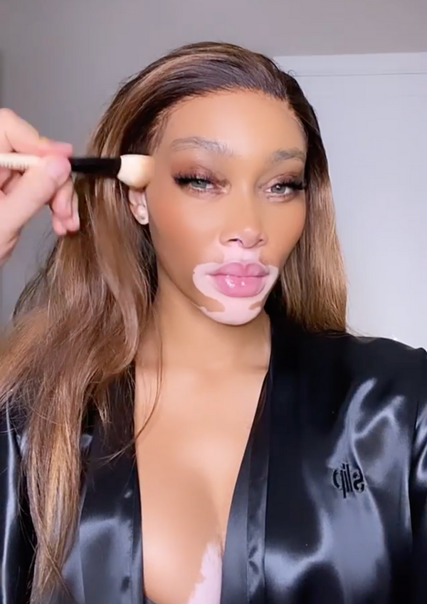 Winnie Harlow
